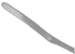 Spatula For Dalk Procedure